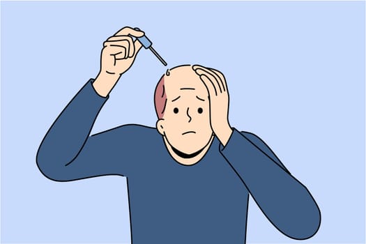 Man treats baldness with dropper of doctor-recommended healing oil that improves hair growth and makes him look attractive. Problem of baldness worries adult guy during midlife crisis
