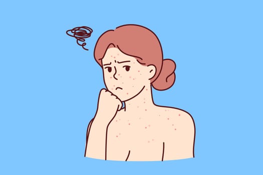 Woman with allergic rash on face and body looks sadly at screen, needing help of dermatologist. Rash covering girl skin due to poor hygiene or lack of vitamins that strengthen immune system