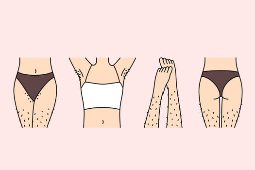 Hairy female legs and thighs in need of depilation or epilation using wax tape and sugaring. Body parts of girl in underwear, for advertising depilation services from cosmetologist