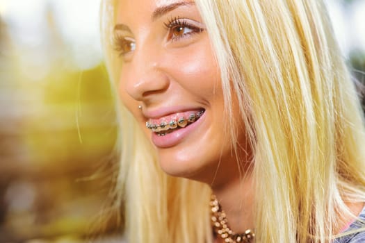 Detail of braces in the smiling mouth of an attractive young blond woman. Side portrait with rays of sunlight and warm colors. She is in a public place such as a park or a forest and the braces look g