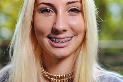 Detail of braces in the smiling mouth of an attractive young blond woman. She is in a public place such as a park or a forest and the braces look good on her as she smiles-she has nothing to be ashame