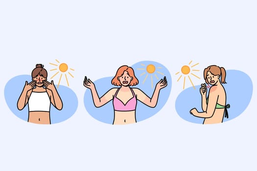 Sunburns on bodies of shocked women relaxing on beach and not using sunscreen and uv rays. Problem of sunburns or uneven tanning among girls visiting southern islands for first time