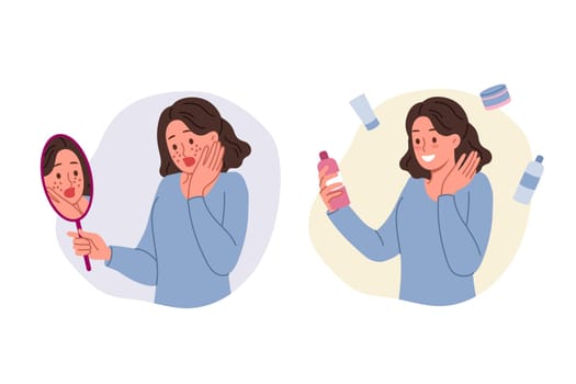 Teenage girl with pimples on face holds mirror and cream to get rid of traces of hormonal explosion. Puberty in young woman caused appearance of rashes or pimples and freckles on skin