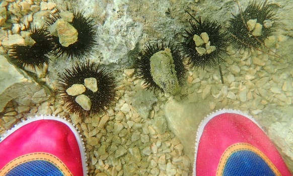 Bathing shoes can protect against injuries from sea urchins in the sea