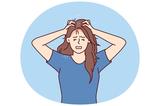 Woman suffers from itchy head after fungal infection and dandruff associated with poor-quality hair shampoo. Girl needs trip to dermatologist and use of new hygiene products or medicines for dandruff