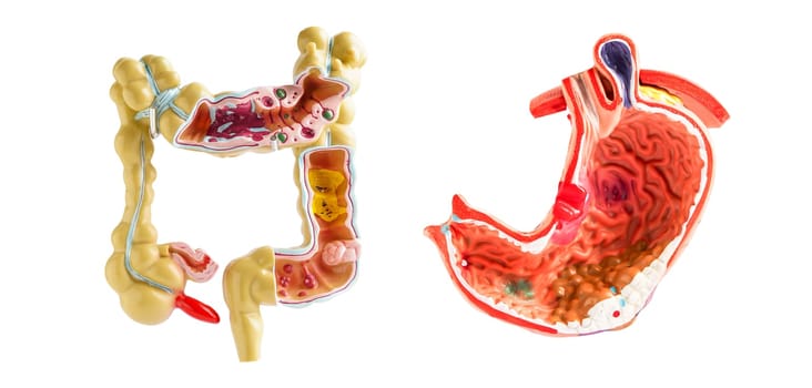 Intestine and stomach model isolated on white background, doctor holding anatomy model for study diagnosis and treatment in hospital.