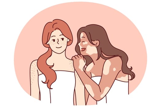 Woman with vitiligo syndrome hugs friend in bath towel and laughs enjoying fellowship and tolerance. Two cheerful girlfriends with freckles on skin or spots associated with vitiligo pigmentation