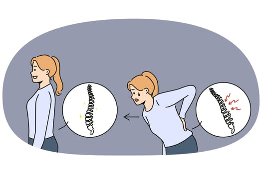 Woman with sick spine near healthy girl with good posture who underwent chiropractic procedure. Concept of spinal injury and need for therapeutic massage from osteopathy or chiropractic doctor