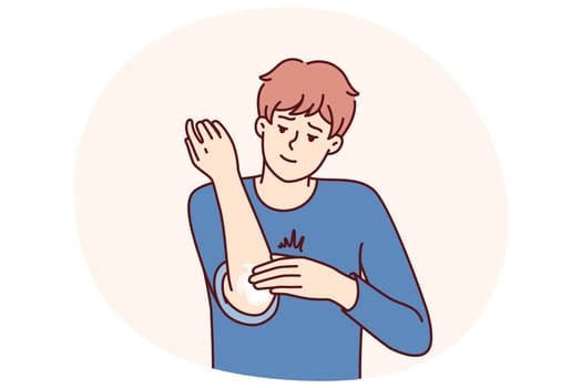 Man smears elbow with healing ointment after bruise or skin problems and acne. Young guy uses analgesic dermatological ointment to treat elbow joint and take care of skin in need of moisture