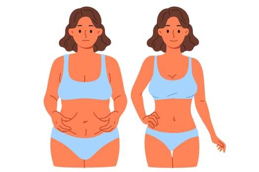 Thinner woman compares result before and after using new diet or joining fitness club with personal trainer. Thinner girl in swimsuit shows off excellent effect of liposuction done by surgeon