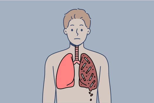 Man smoker with destroyed lungs is forced to suffer due to addiction of tobacco and nicotine. Guy who smokes needs surgery due to smoking for long time and lack of willpower for fight bad habit.