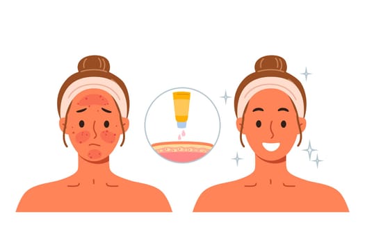 Sunscreen that protects skin from burns and solar radiation, next to girls demonstrating results before and after. Sunscreen for solarium visitors or tourists vacationing in tropical countries