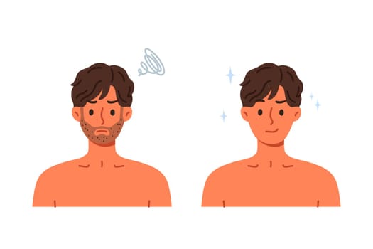 Unshaven man was transformed and became handsome after using razor with sharp blade. Guy recommends new shaving foam or high-quality razor that allows you to avoid discomfort and itching