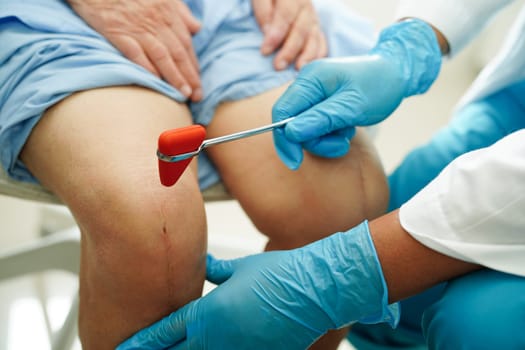 Asian doctor knock on knee reflex nerve for check and treatment senior patient in hospital.