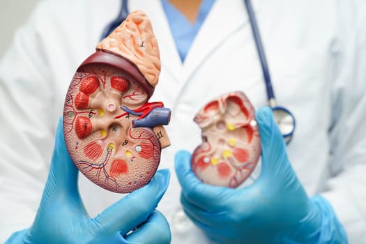 Chronic kidney disease, doctor with model for treatment urinary system, urology, Estimated glomerular filtration rate eGFR.