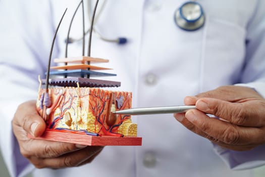 Hair transplant, Asian dermatologist doctor holding skin structure anatomy model for treatment in hospital.