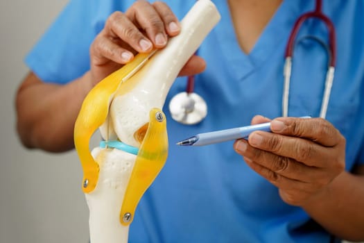 Knee osteoarthritis, Doctor showing model knee joint orthopedic.