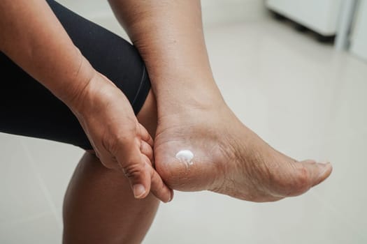 Asian woman applying moisturizing cream skincare treatment to solve and repair feet with crack and dry heel skin.