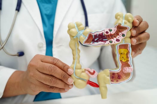 Intestine, doctor holding human anatomy model for study diagnosis and treatment in hospital.