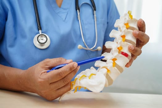 Asian doctor holding spinal nerve and bone model, Lumbar spine displaced herniated disc fragment for treatment medical in the orthopedic department.
