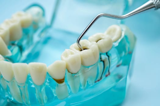 Teeth dental model with tool for dentist use to cleaning care treatment.