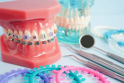 Orthodontic ligatures rings and ties, elastic rubber bands on orthodontic braces, model for dentist studying about dentistry.
