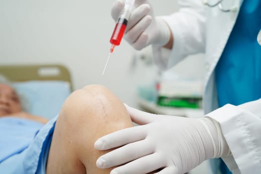 Asian doctor inject Hyaluronic acid platelet rich plasma into the knee of senior woman to walk without pain.