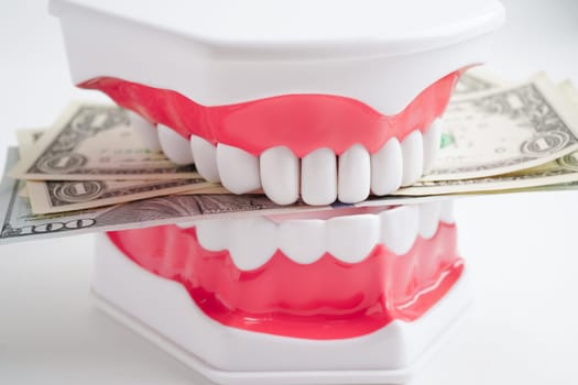 Treatment dental care cost, dental expense or fee, US dollar banknote money with teeth model.