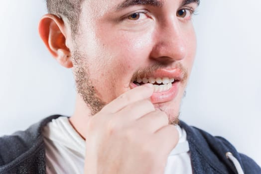 Close up of man with dermatophagia, biting his nails. Person biting nails isolated