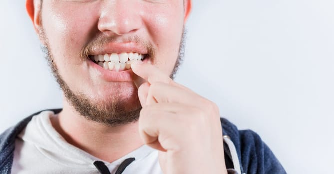 Person biting nails isolated. Close up of man with dermatophagia, biting his nails