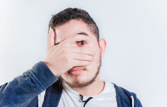 Unhappy man with conjunctivitis isolated. Person with irritated eyes looking at camera