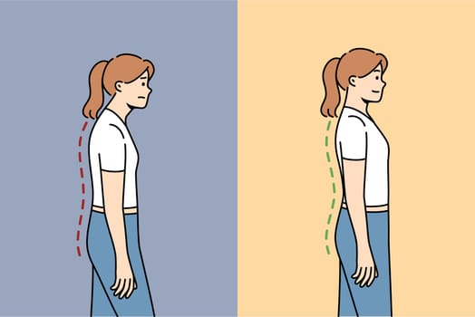 Scoliosis or osteochondrosis in woman, due to problems with posture and sore spine, which has recovered after doing fitness. Problem scoliosis in female office employee because of sedentary lifestyle