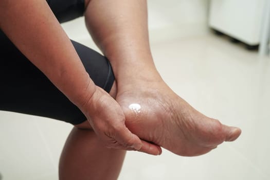 Asian woman applying moisturizing cream skincare treatment to solve and repair feet with crack and dry heel skin.