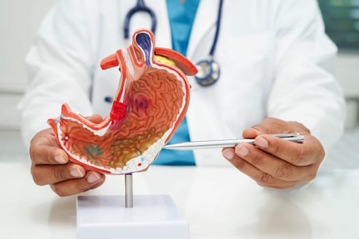 Stomach disease, doctor holding anatomy model for study diagnosis and treatment in hospital.
