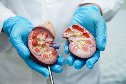 Chronic kidney disease, doctor with model for treatment urinary system, urology, Estimated glomerular filtration rate eGFR.