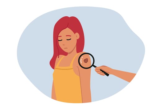 Melanoma or malignant tumor found on shoulder of woman standing near magnifying glass. Girl with cancer suffers from melanoma caused by bad climate or hereditary disease inherited from parents