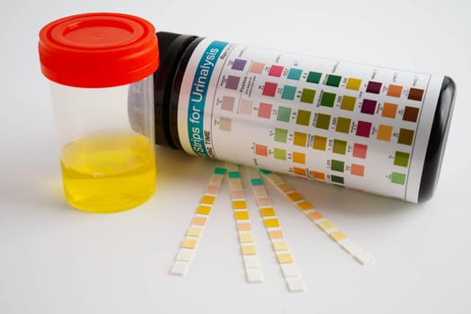 Urinalysis, urine cup with reagent strip pH paper test and comparison chart in laboratory.