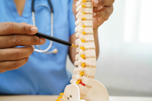 Asian doctor holding spinal nerve and bone model, Lumbar spine displaced herniated disc fragment for treatment medical in the orthopedic department.