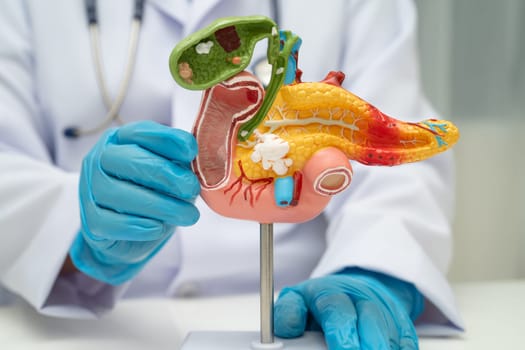 Pancreatitis, pancreatic cancer, Asian doctor with pancreas, gallbladder and bile duct human anatomy model at hospital.