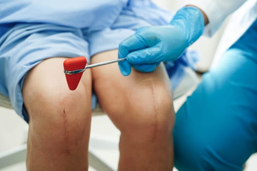 Asian doctor knock on knee reflex nerve for check and treatment senior patient in hospital.