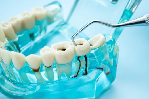 Teeth dental model with tool for dentist use to cleaning care treatment.