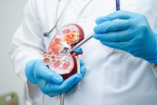 Chronic kidney disease, doctor with model for treatment urinary system, urology, Estimated glomerular filtration rate eGFR.