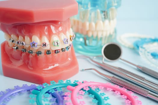 Orthodontic ligatures rings and ties, elastic rubber bands on orthodontic braces, model for dentist studying about dentistry.