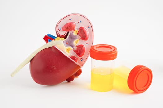 Urinalysis, Kidney and urine cup for check health examination in laboratory.