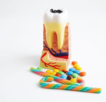 Dental implant, artificial tooth roots into jaw, root canal of dental treatment, gum disease, teeth model for dentist studying about dentistry.