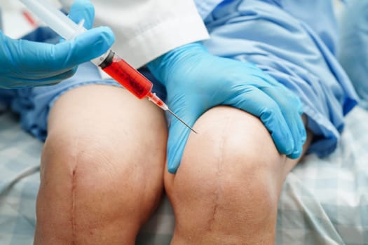 Asian doctor inject Hyaluronic acid platelet rich plasma into the knee of senior woman to walk without pain.