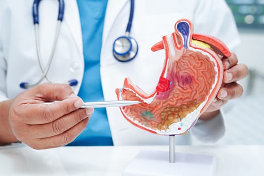 Stomach disease, doctor holding anatomy model for study diagnosis and treatment in hospital.