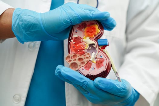 Chronic kidney disease, doctor with model for treatment urinary system, urology, Estimated glomerular filtration rate eGFR.
