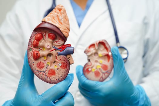 Chronic kidney disease, doctor with model for treatment urinary system, urology, Estimated glomerular filtration rate eGFR.