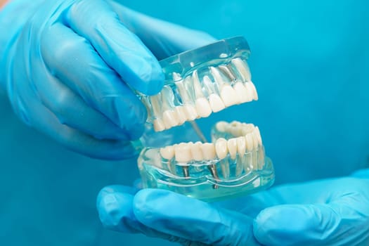Asian dentist holding dental teeth model for learn about dentistry.